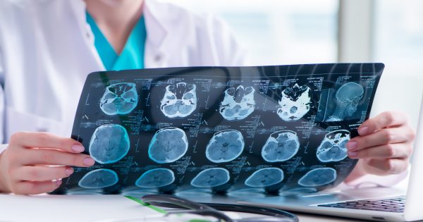 Doctor,Examining,Mri,Image,In,Hospital